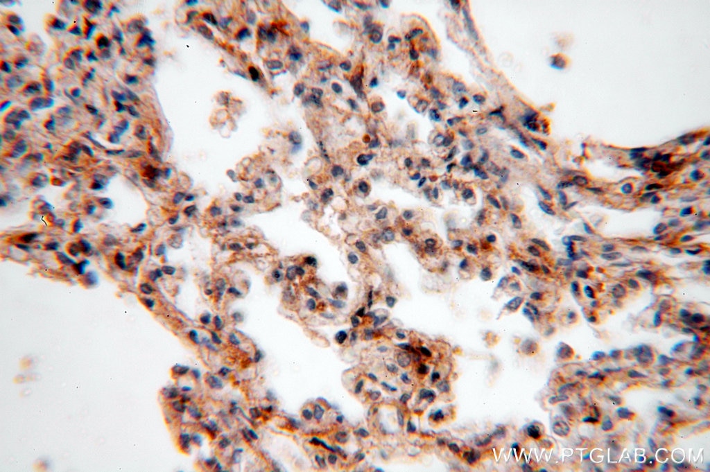 Immunohistochemistry (IHC) staining of human lung tissue using NSDHL Polyclonal antibody (15111-1-AP)
