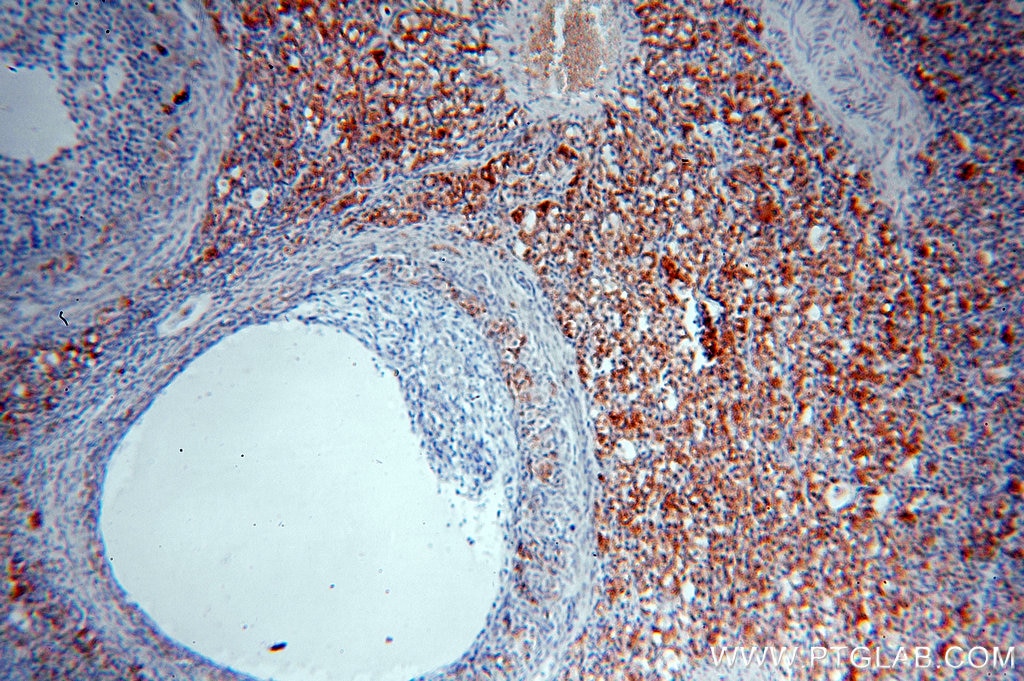 IHC staining of human ovary using 15111-1-AP