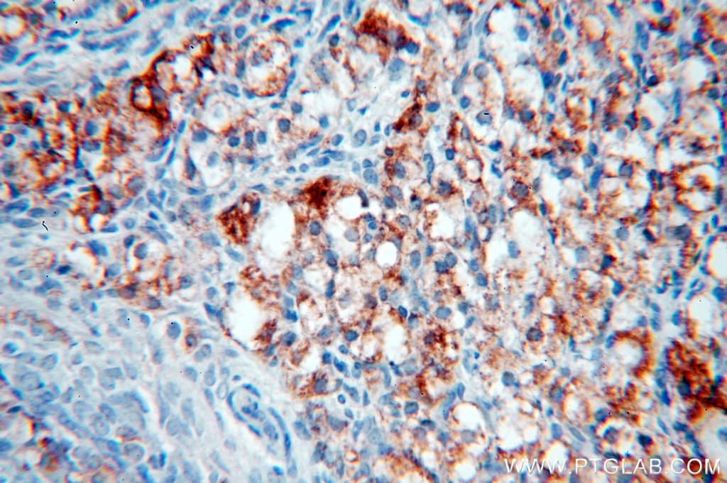 Immunohistochemistry (IHC) staining of human ovary tissue using NSDHL Polyclonal antibody (15111-1-AP)