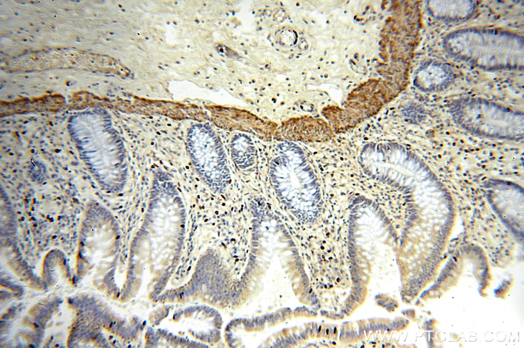 Immunohistochemistry (IHC) staining of human colon tissue using NSDHL Polyclonal antibody (15111-1-AP)