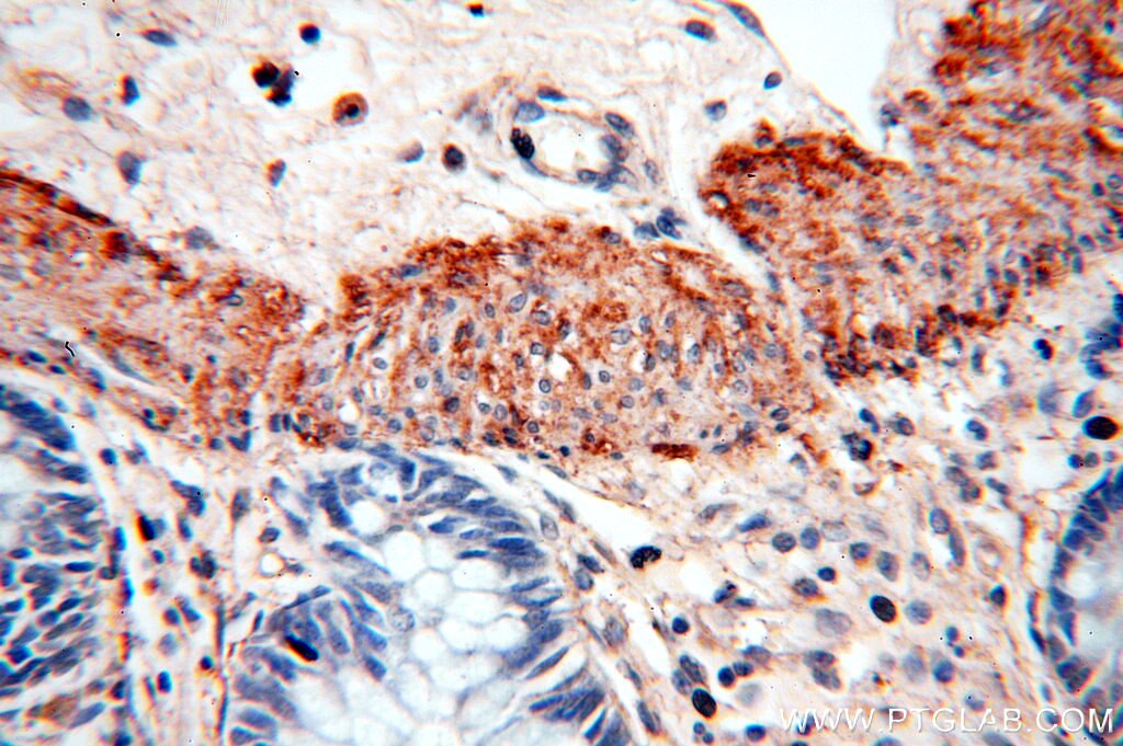 Immunohistochemistry (IHC) staining of human colon tissue using NSDHL Polyclonal antibody (15111-1-AP)