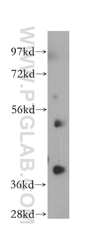 Western Blot (WB) analysis of mouse brain tissue using NSDHL Polyclonal antibody (15111-1-AP)