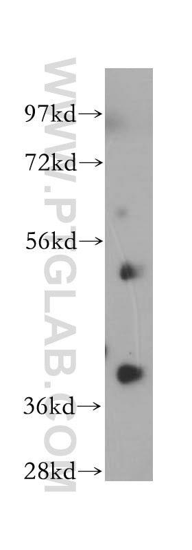 Western Blot (WB) analysis of mouse brain tissue using NSDHL Polyclonal antibody (15111-1-AP)