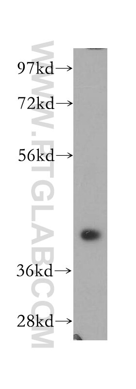 Western Blot (WB) analysis of human heart tissue using NSDHL Polyclonal antibody (15111-1-AP)