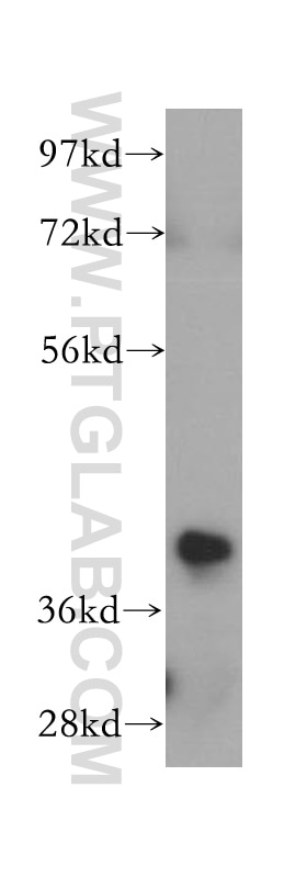 Western Blot (WB) analysis of HeLa cells using NSDHL Polyclonal antibody (15111-1-AP)