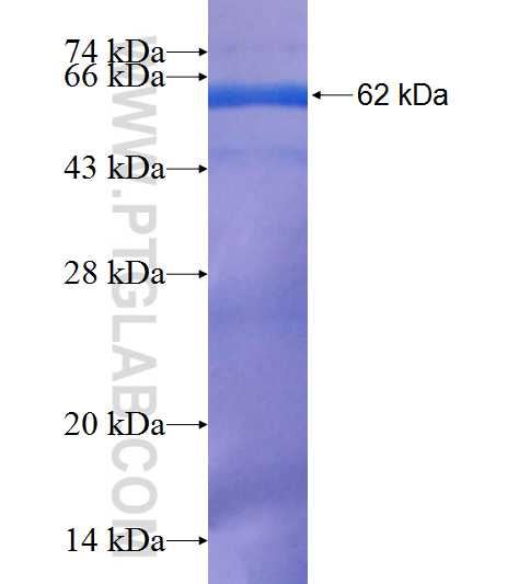 NSDHL fusion protein Ag7097 SDS-PAGE