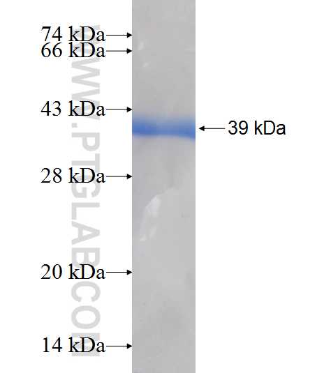 NSDHL fusion protein Ag7230 SDS-PAGE