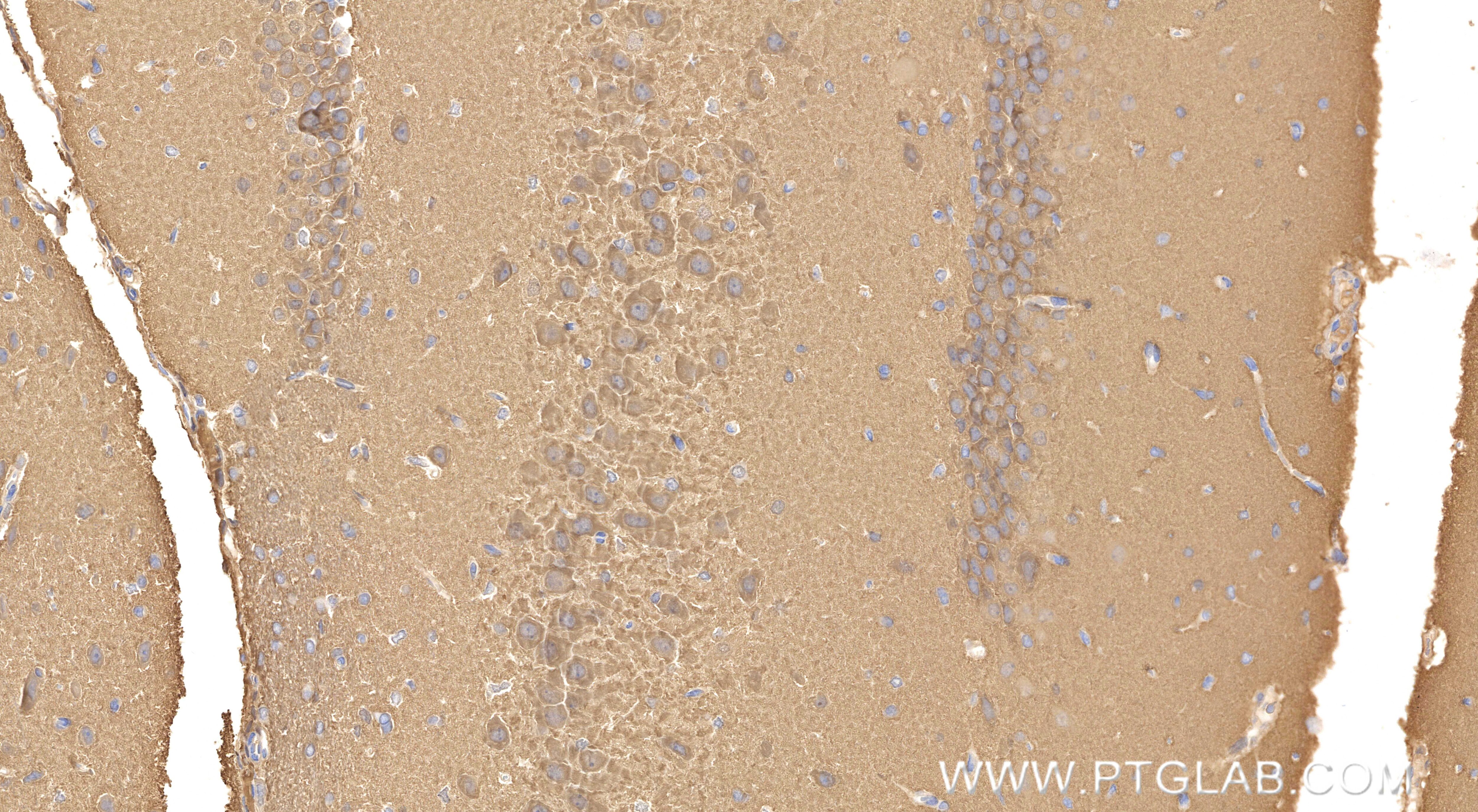 Immunohistochemistry (IHC) staining of rat brain tissue using NSE Recombinant monoclonal antibody (86332-1-RR)