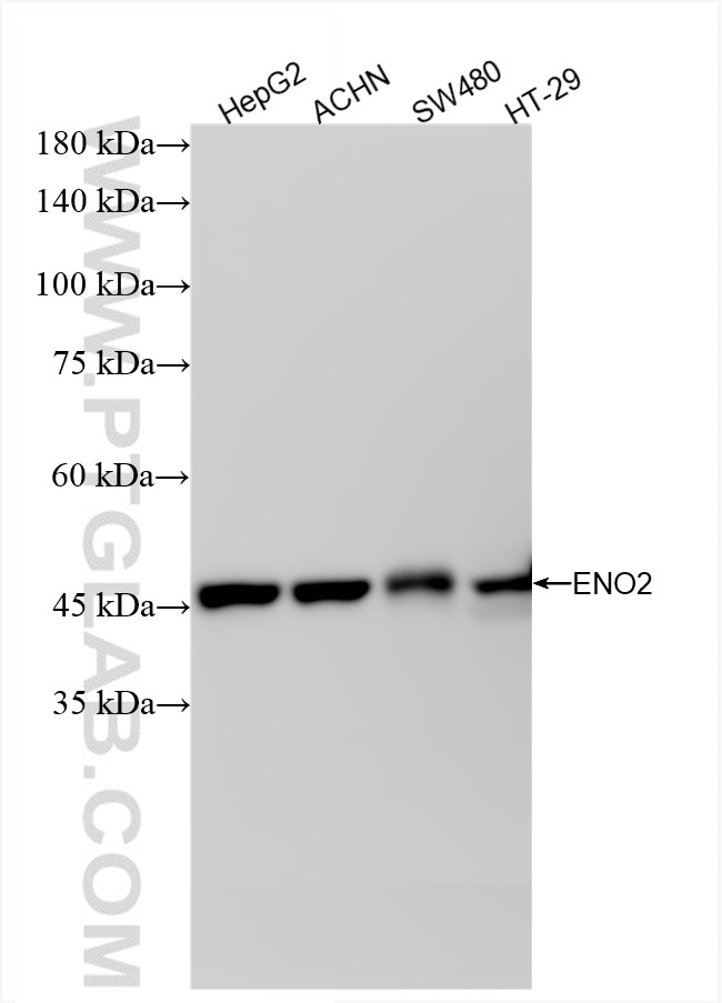 Western Blot (WB) analysis of various lysates using NSE Recombinant antibody (86332-1-RR)