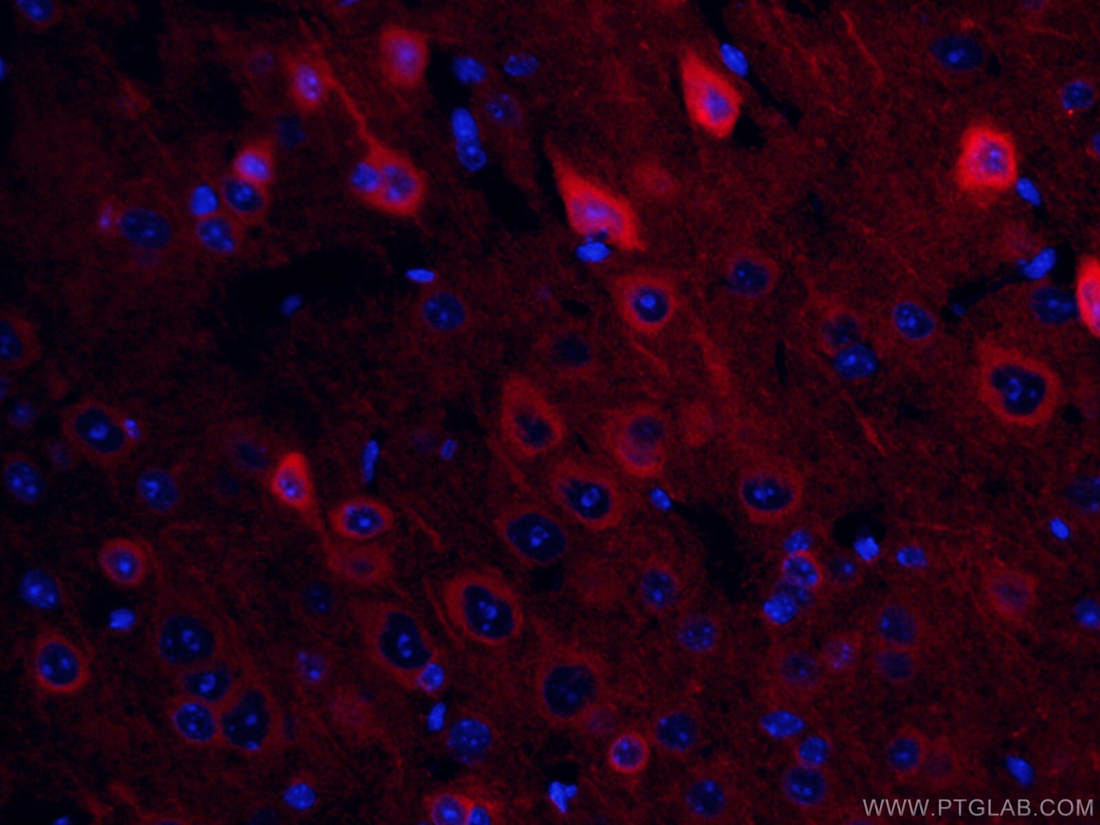 IF Staining of mouse brain using CL594-66150