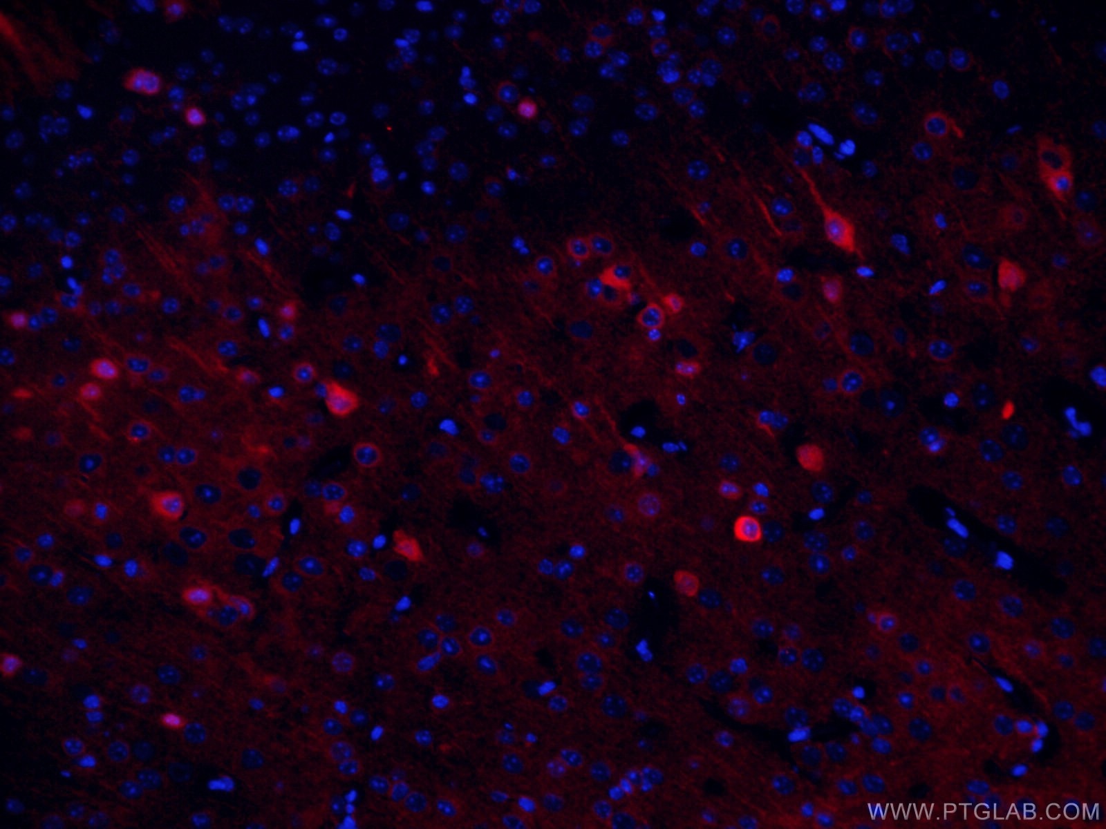 Immunofluorescence (IF) / fluorescent staining of mouse brain tissue using CoraLite®594-conjugated NSE Monoclonal antibody (CL594-66150)