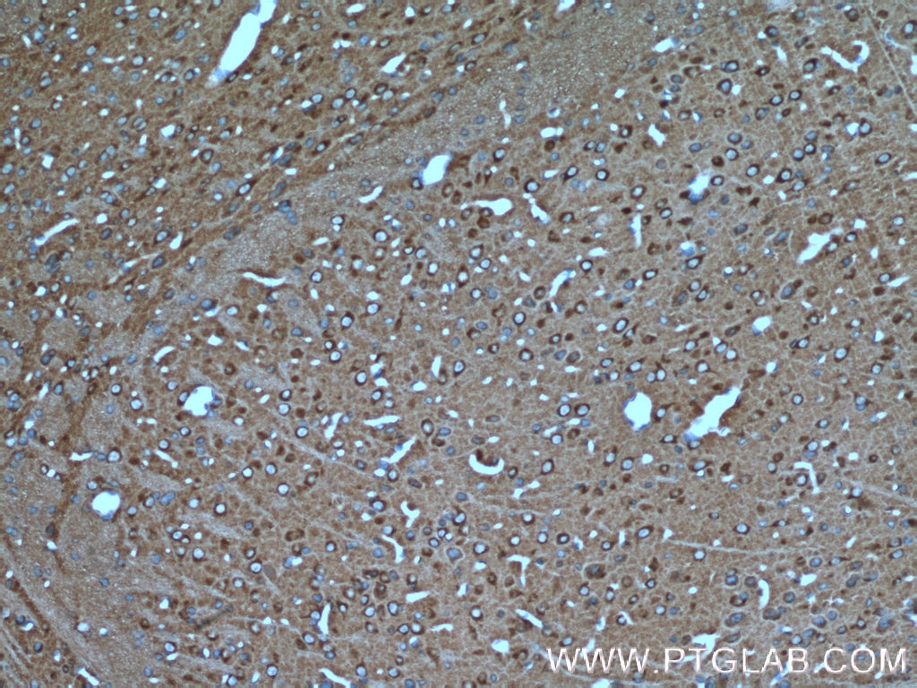 Immunohistochemistry (IHC) staining of mouse brain tissue using NSF Polyclonal antibody (21172-1-AP)