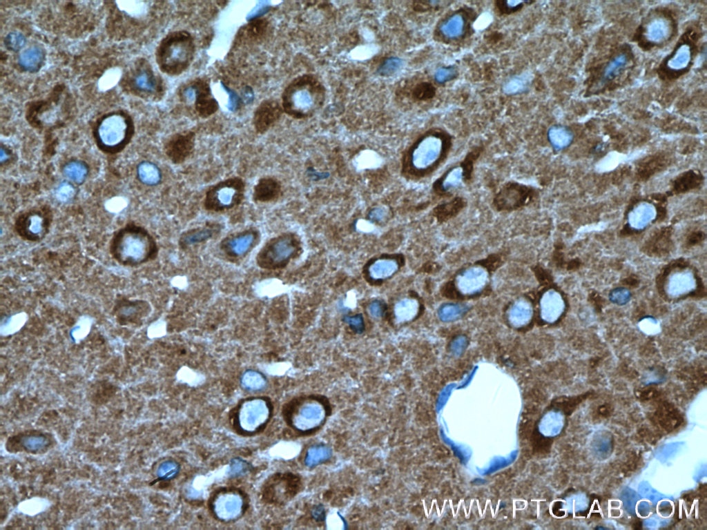 Immunohistochemistry (IHC) staining of mouse brain tissue using NSF Polyclonal antibody (21172-1-AP)