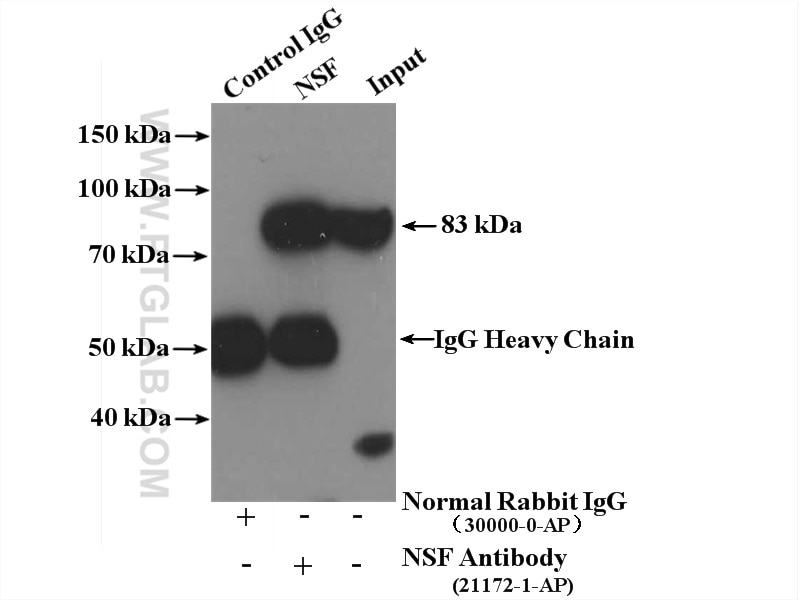 Immunoprecipitation (IP) experiment of mouse brain tissue using NSF Polyclonal antibody (21172-1-AP)