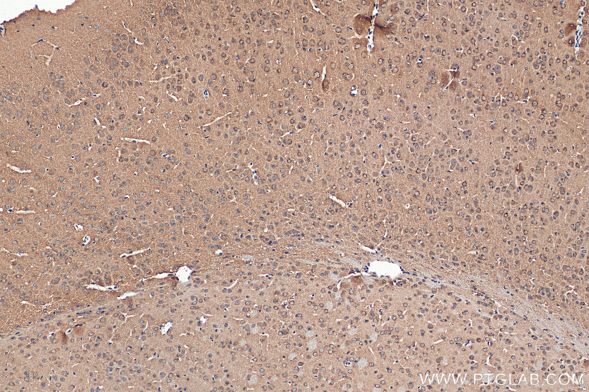 Immunohistochemistry (IHC) staining of mouse brain tissue using NSF Polyclonal antibody (28837-1-AP)