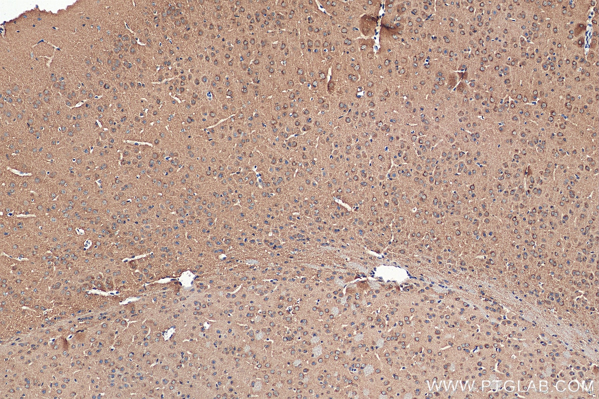 Immunohistochemistry (IHC) staining of mouse brain tissue using NSF Polyclonal antibody (28837-1-AP)