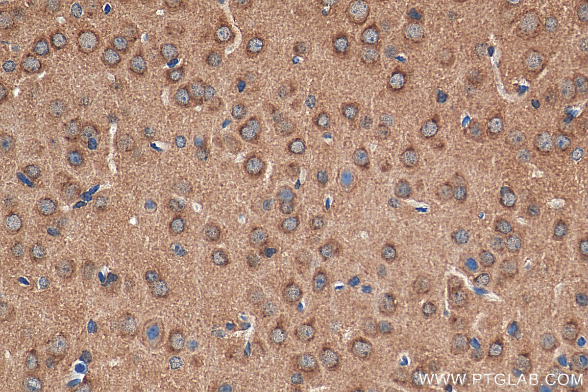 Immunohistochemistry (IHC) staining of mouse brain tissue using NSF Polyclonal antibody (28837-1-AP)