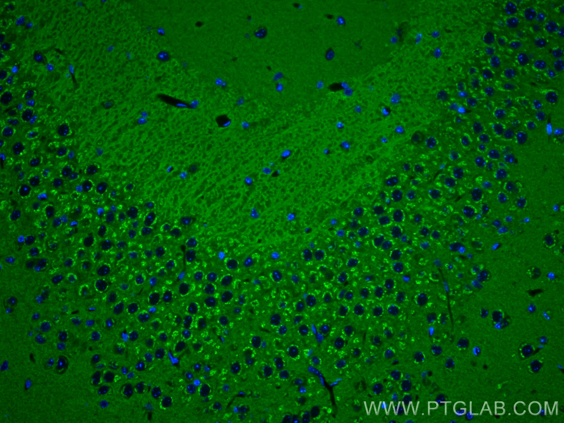 Immunofluorescence (IF) / fluorescent staining of mouse brain tissue using NSF Monoclonal antibody (68061-1-Ig)