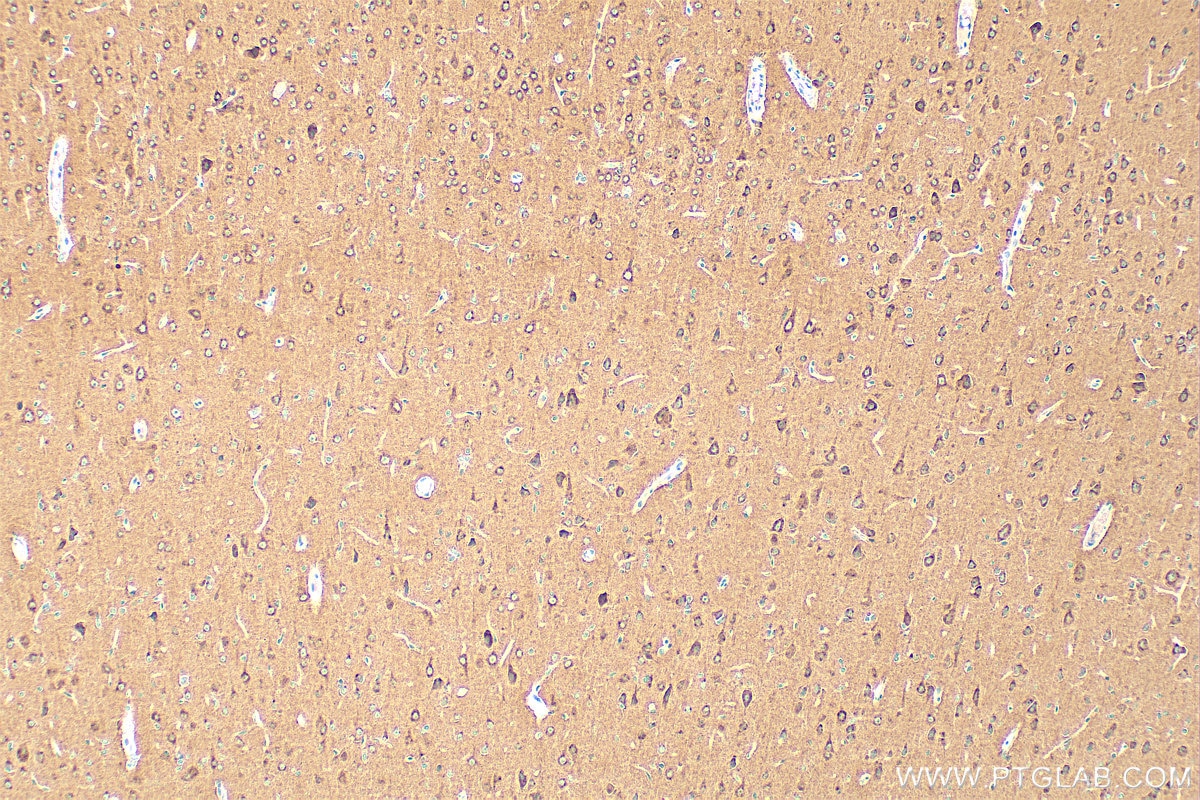 Immunohistochemistry (IHC) staining of rat brain tissue using NSF Monoclonal antibody (68061-1-Ig)