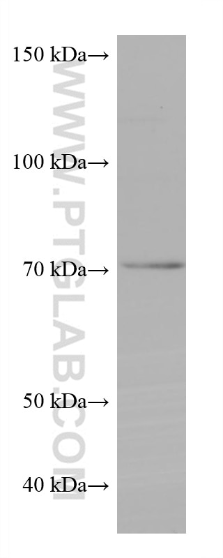 Western Blot (WB) analysis of SH-SY5Y cells using NSF Monoclonal antibody (68061-1-Ig)