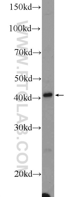 Western Blot (WB) analysis of mouse liver tissue using NSFL1C Polyclonal antibody (15620-1-AP)