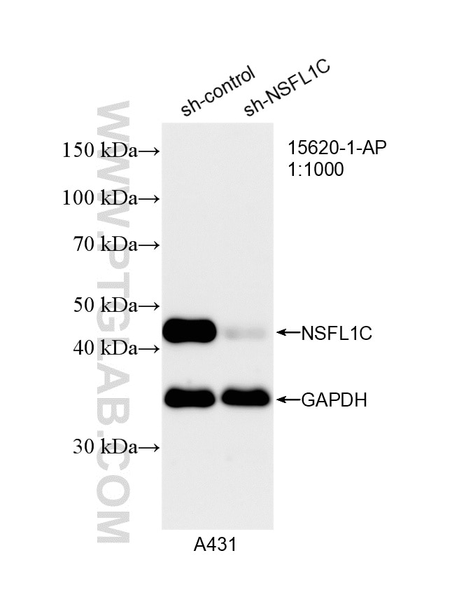 Western Blot (WB) analysis of A431 cells using NSFL1C Polyclonal antibody (15620-1-AP)
