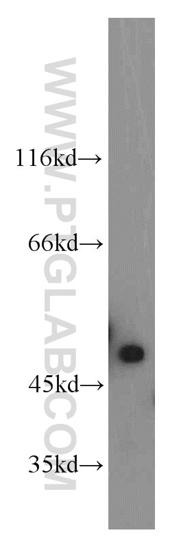 Western Blot (WB) analysis of HEK-293 cells using NSFL1C Polyclonal antibody (15620-1-AP)