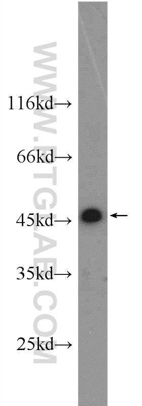 Western Blot (WB) analysis of A431 cells using NSFL1C Polyclonal antibody (15620-1-AP)