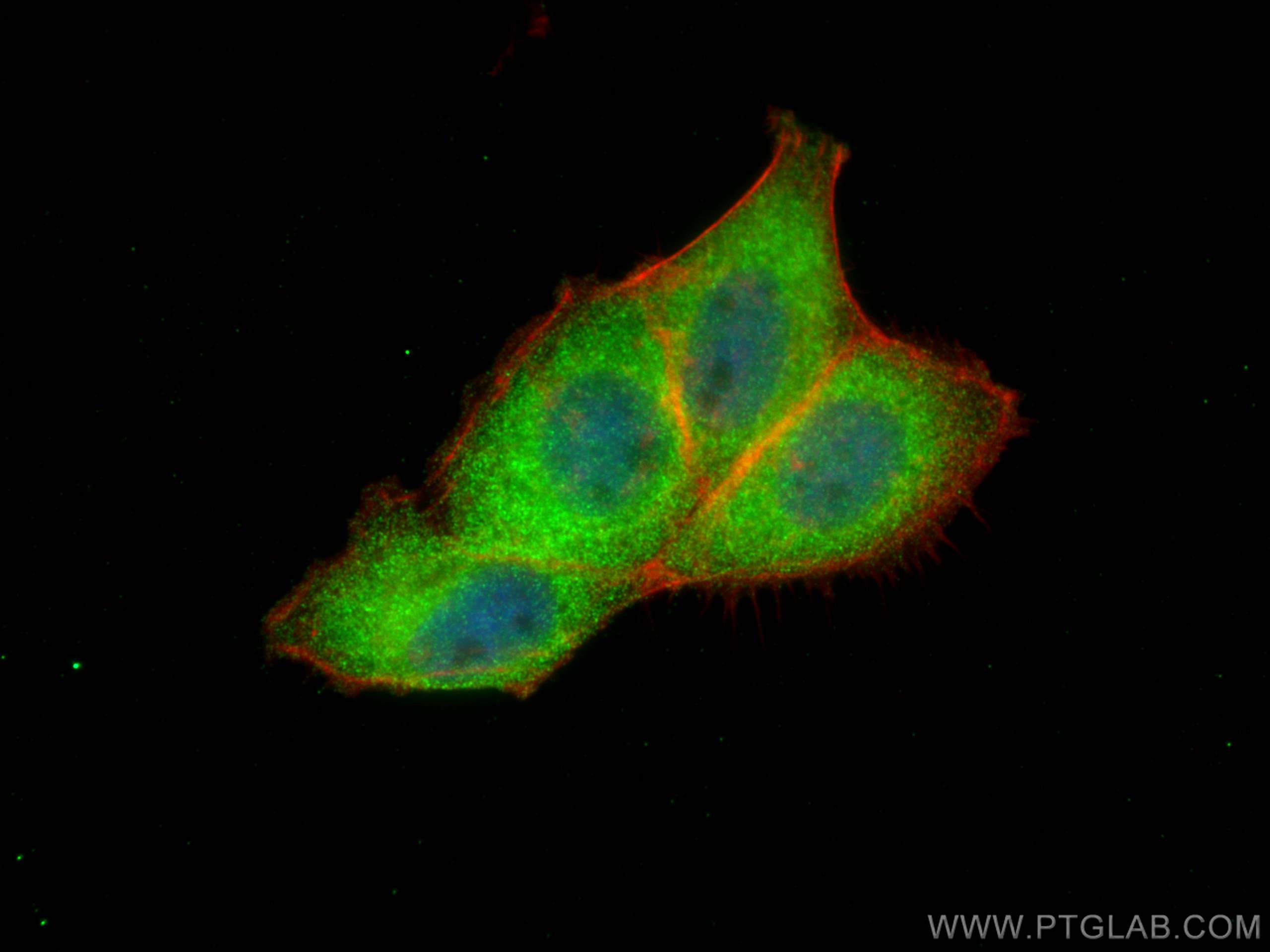 Immunofluorescence (IF) / fluorescent staining of A431 cells using NSFL1C Monoclonal antibody (68182-1-Ig)
