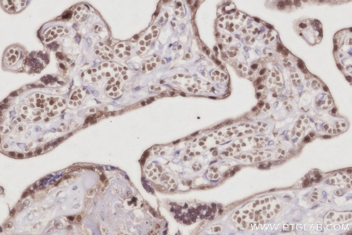 IHC staining of human placenta using 68182-1-Ig Immunohistochemistry (IHC) staining of human placenta tissue using NSFL1C Monoclonal antibody (68182-1-Ig)