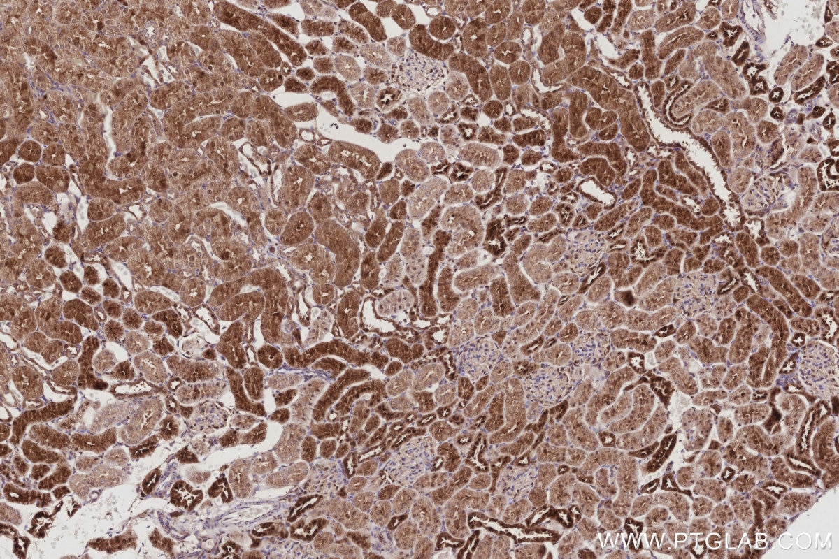 IHC staining of rat kidney using 68182-1-Ig Immunohistochemistry (IHC) staining of rat kidney tissue using NSFL1C Monoclonal antibody (68182-1-Ig)