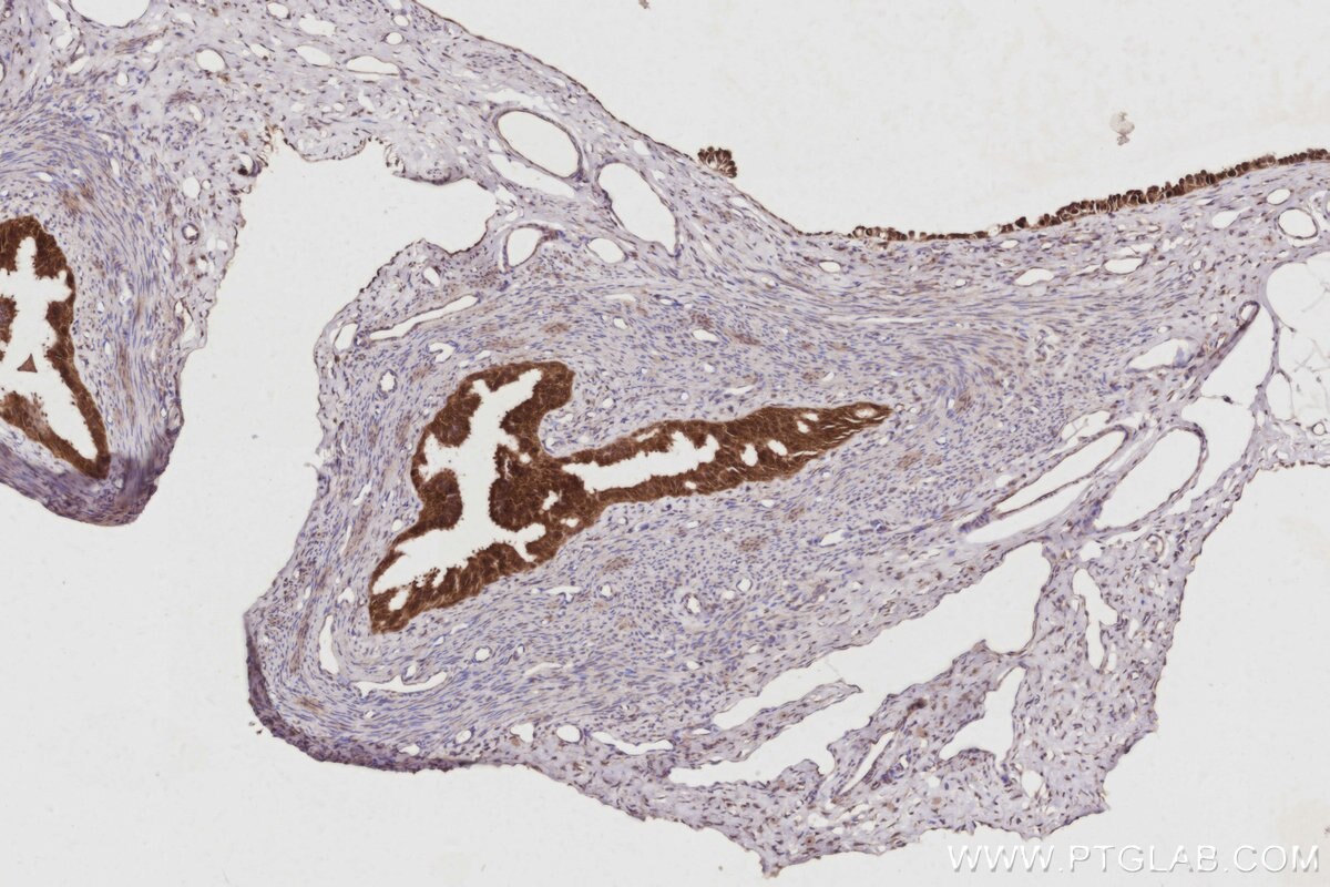 IHC staining of rat ovary using 68182-1-Ig Immunohistochemistry (IHC) staining of rat ovary tissue using NSFL1C Monoclonal antibody (68182-1-Ig)