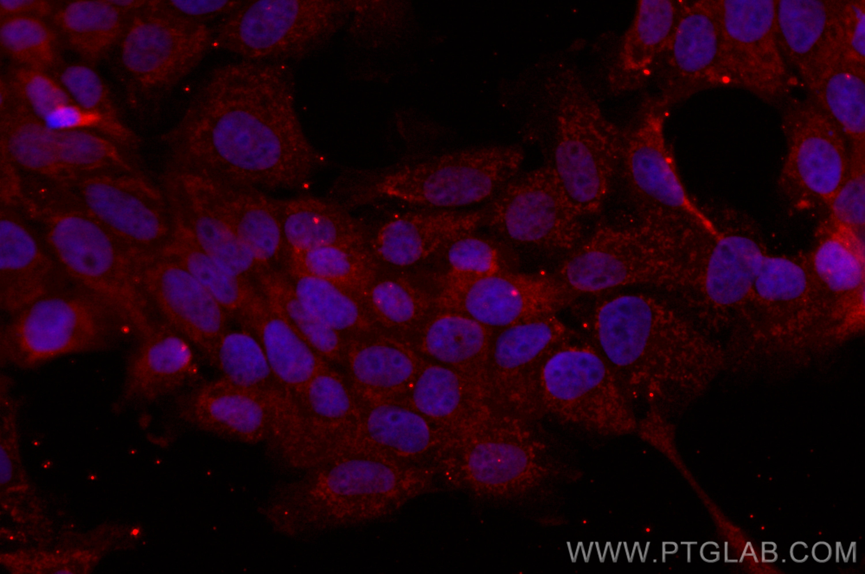 Immunofluorescence (IF) / fluorescent staining of A431 cells using CoraLite® Plus 555-conjugated NSFL1C Monoclonal an (CL555-68182)