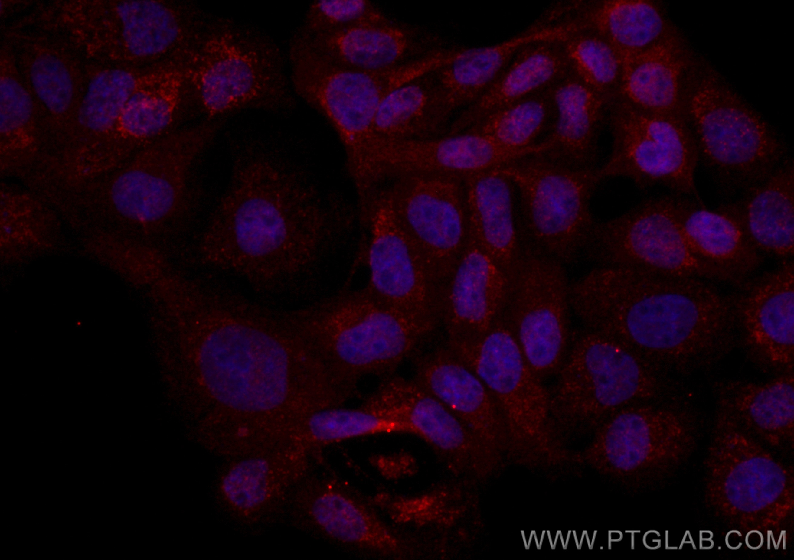 Immunofluorescence (IF) / fluorescent staining of A431 cells using CoraLite® Plus 594-conjugated NSFL1C Monoclonal an (CL594-68182)