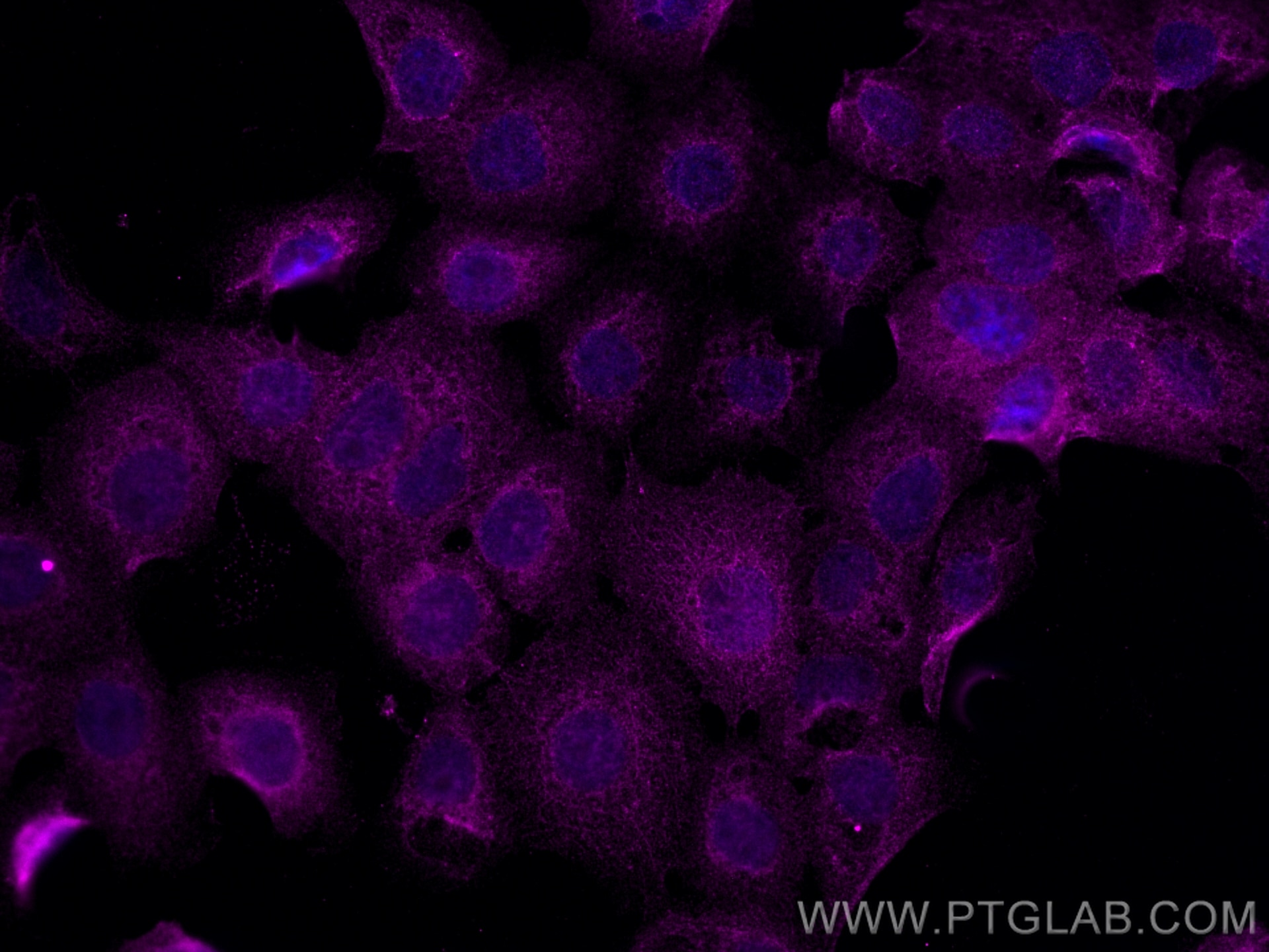 NSFL1C