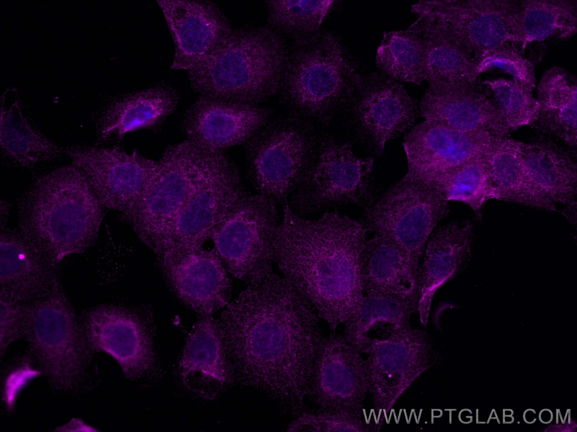 IF Staining of A431 using CL647-68182