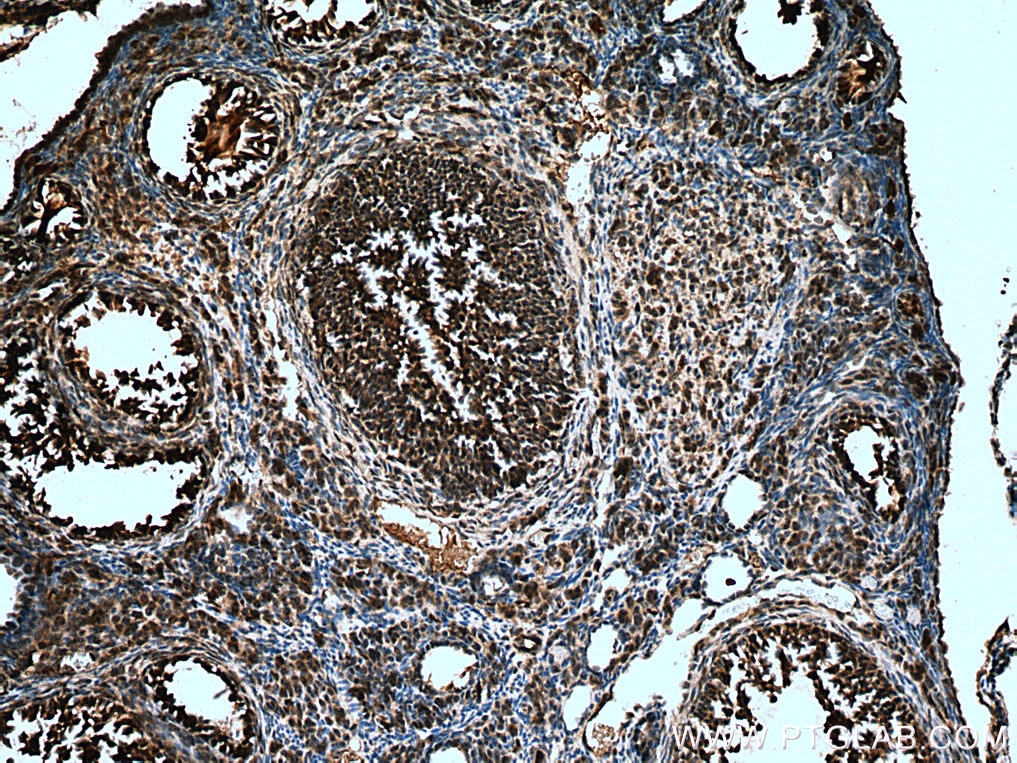 Immunohistochemistry (IHC) staining of mouse ovary tissue using NSMCE2 Polyclonal antibody (13627-1-AP)