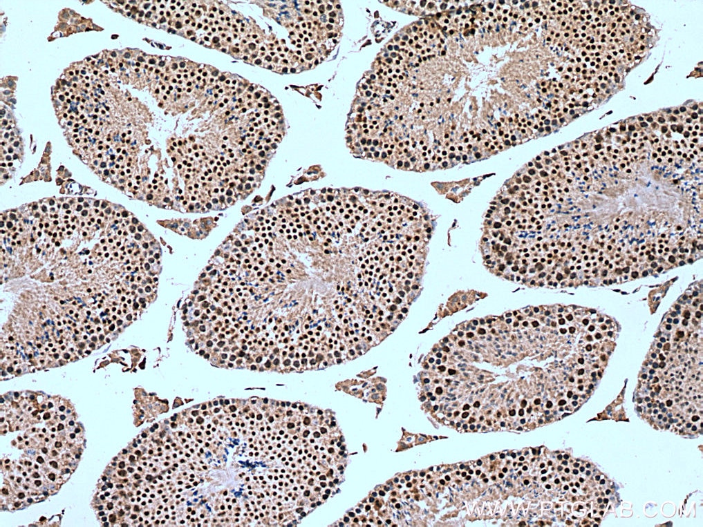 Immunohistochemistry (IHC) staining of mouse testis tissue using NSMCE2 Polyclonal antibody (13627-1-AP)