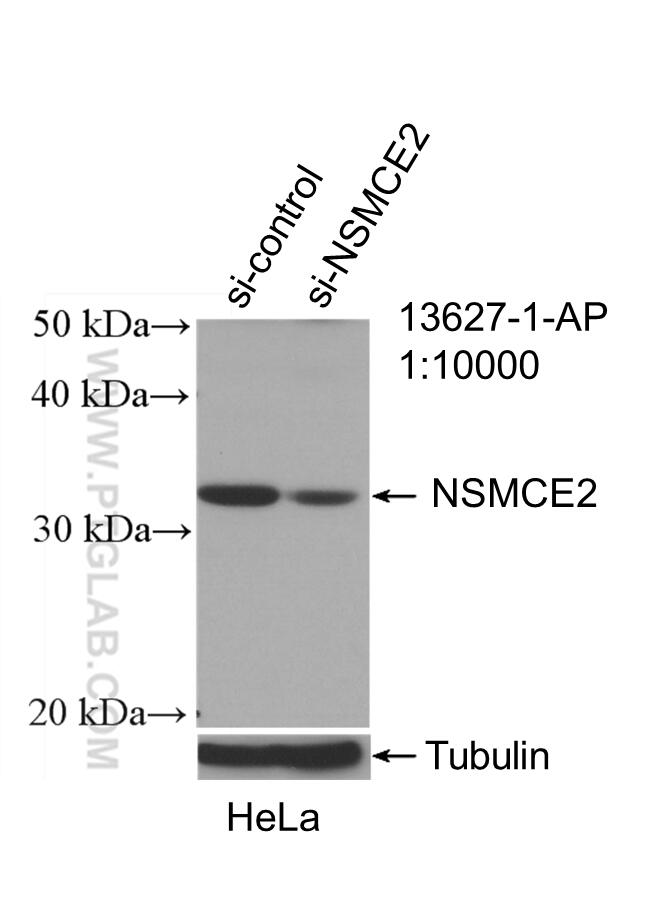 Western Blot (WB) analysis of HeLa cells using NSMCE2 Polyclonal antibody (13627-1-AP)