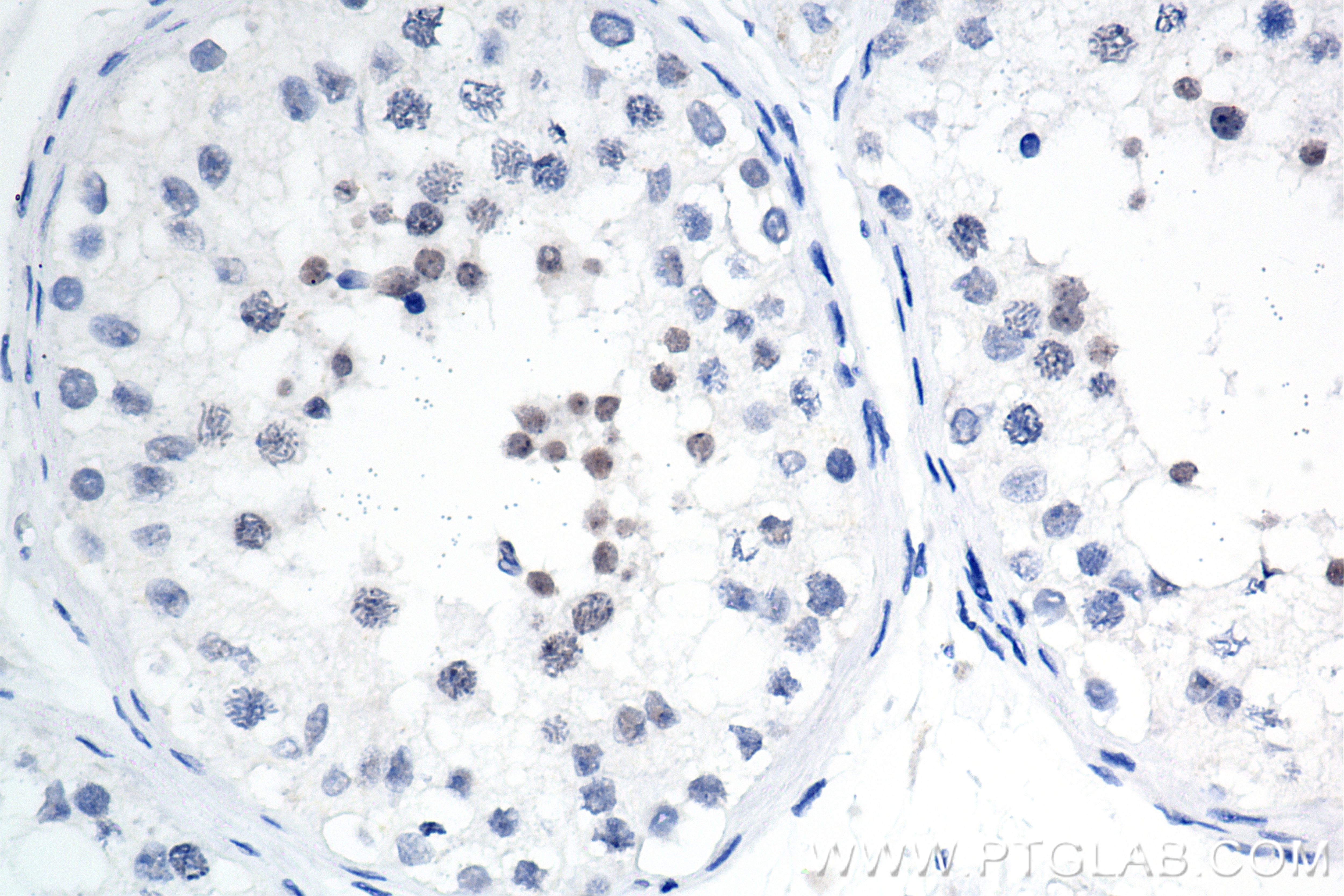 Immunohistochemical analysis of paraffin-embedded human testis tissue slide using 85188-4-RR (NSMCE2 antibody) at dilution of 1:1000 (under 40x lens). Heat mediated antigen retrieval with Tris-EDTA buffer (pH 9.0). This data was developed using the same antibody clone with 85188-4-PBS in a different storage buffer formulation. Immunohistochemistry (IHC) staining of human testis tissue using NSMCE2 Recombinant monoclonal antibody (85188-4-RR)