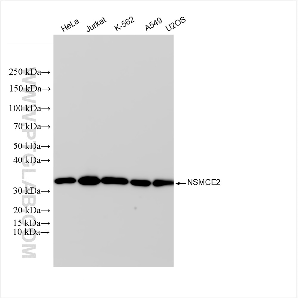 Western Blot (WB) analysis of various lysates using NSMCE2 Recombinant antibody (85188-4-RR)