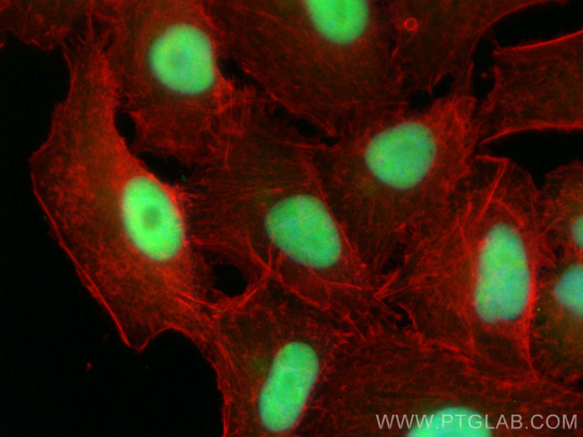 Immunofluorescence (IF) / fluorescent staining of A549 cells using NSUN2 Polyclonal antibody (20854-1-AP)
