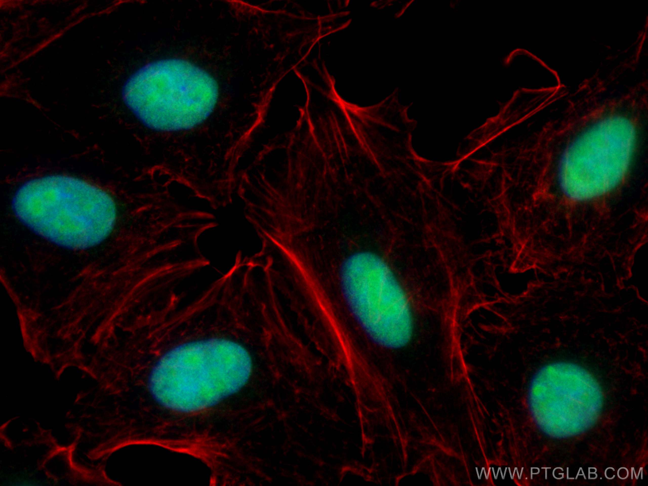 Immunofluorescence (IF) / fluorescent staining of A549 cells using NSUN2 Polyclonal antibody (20854-1-AP)