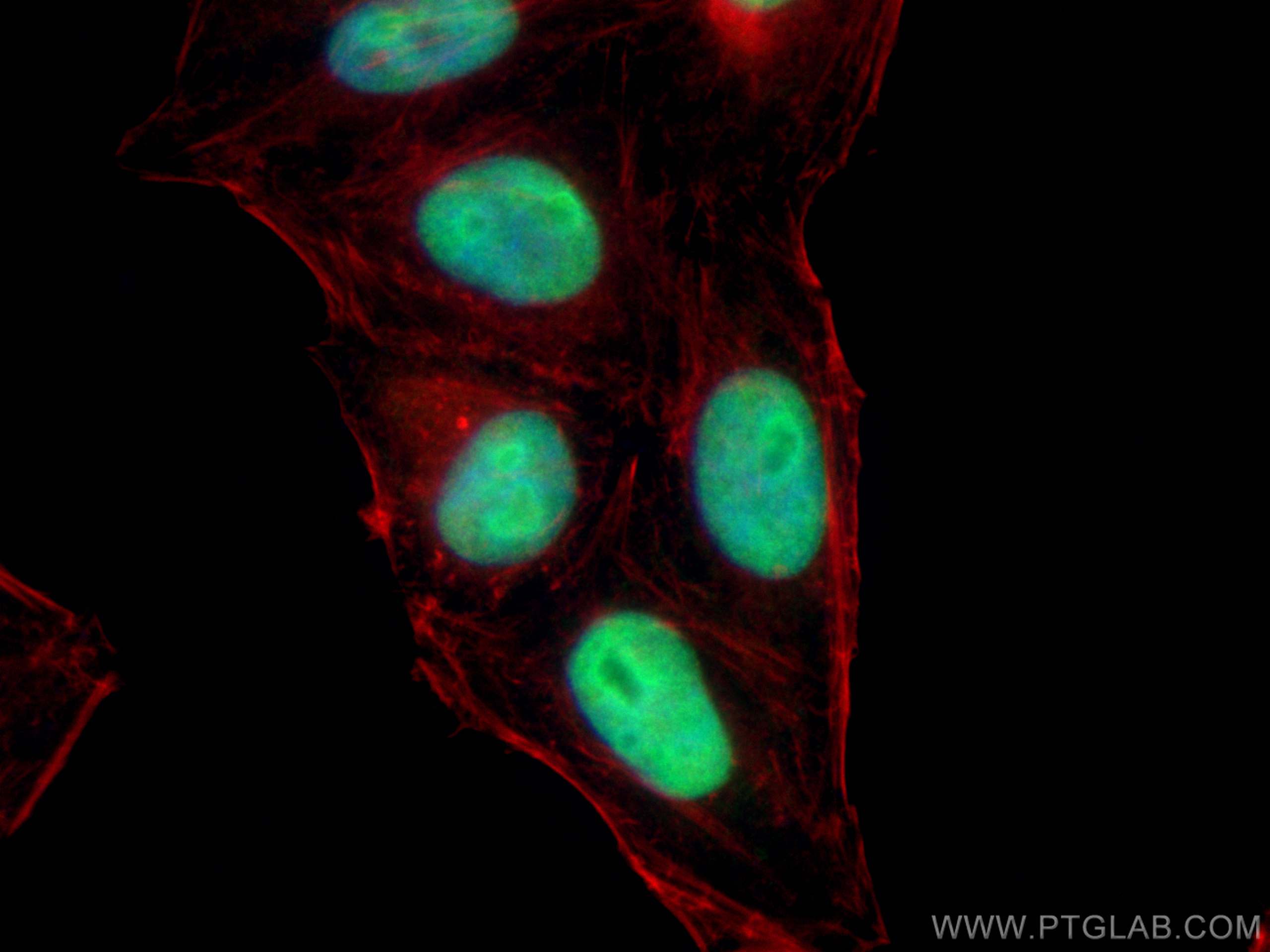 Immunofluorescence (IF) / fluorescent staining of HepG2 cells using NSUN2 Polyclonal antibody (20854-1-AP)
