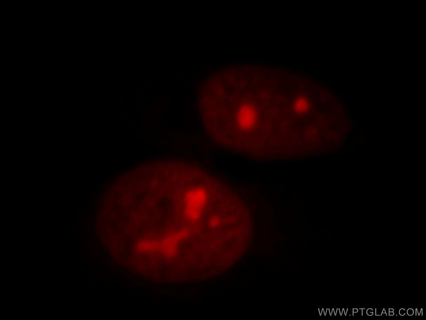 Immunofluorescence (IF) / fluorescent staining of HeLa cells using NSUN2 Polyclonal antibody (20854-1-AP)