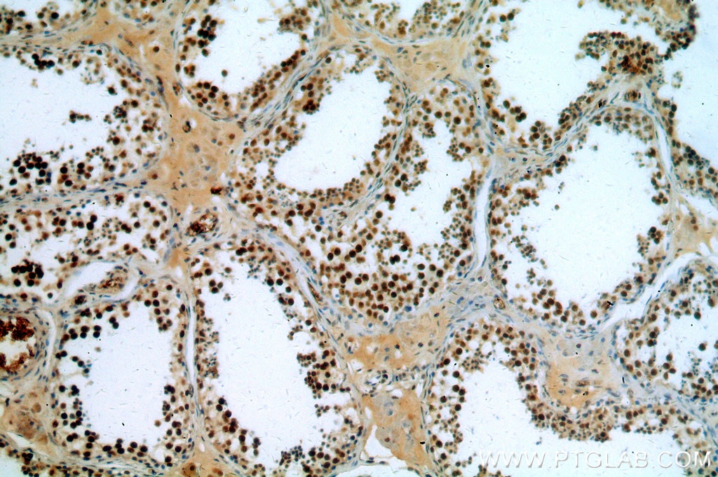 Immunohistochemistry (IHC) staining of human testis tissue using NSUN2 Polyclonal antibody (20854-1-AP)