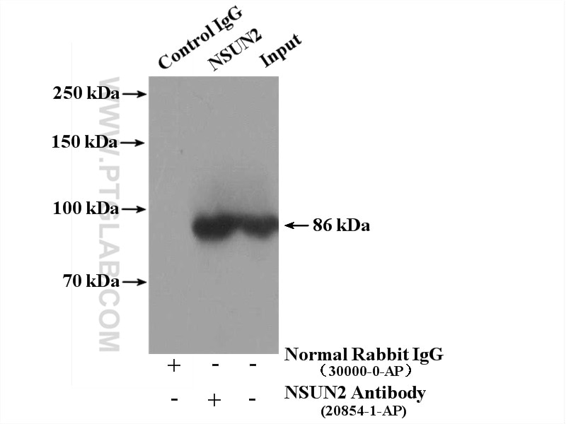 Immunoprecipitation (IP) experiment of HeLa cells using NSUN2 Polyclonal antibody (20854-1-AP)