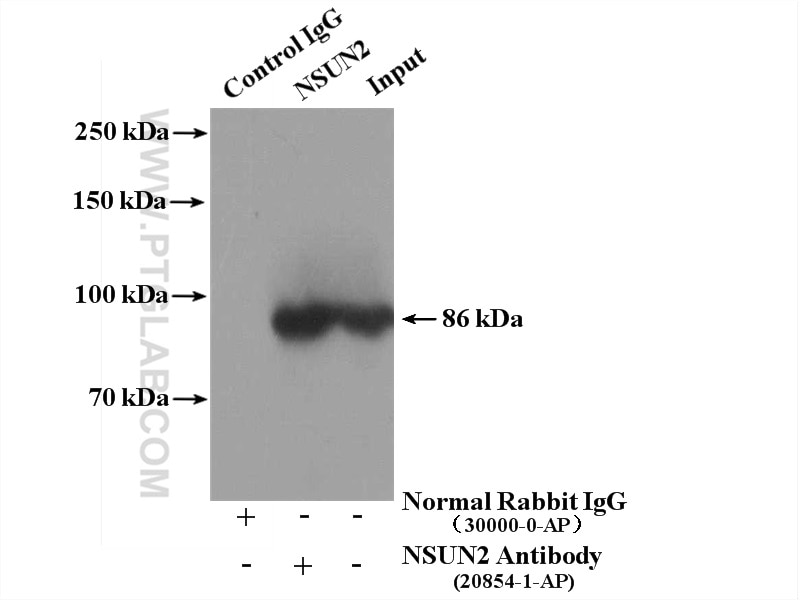 IP experiment of HeLa using 20854-1-AP