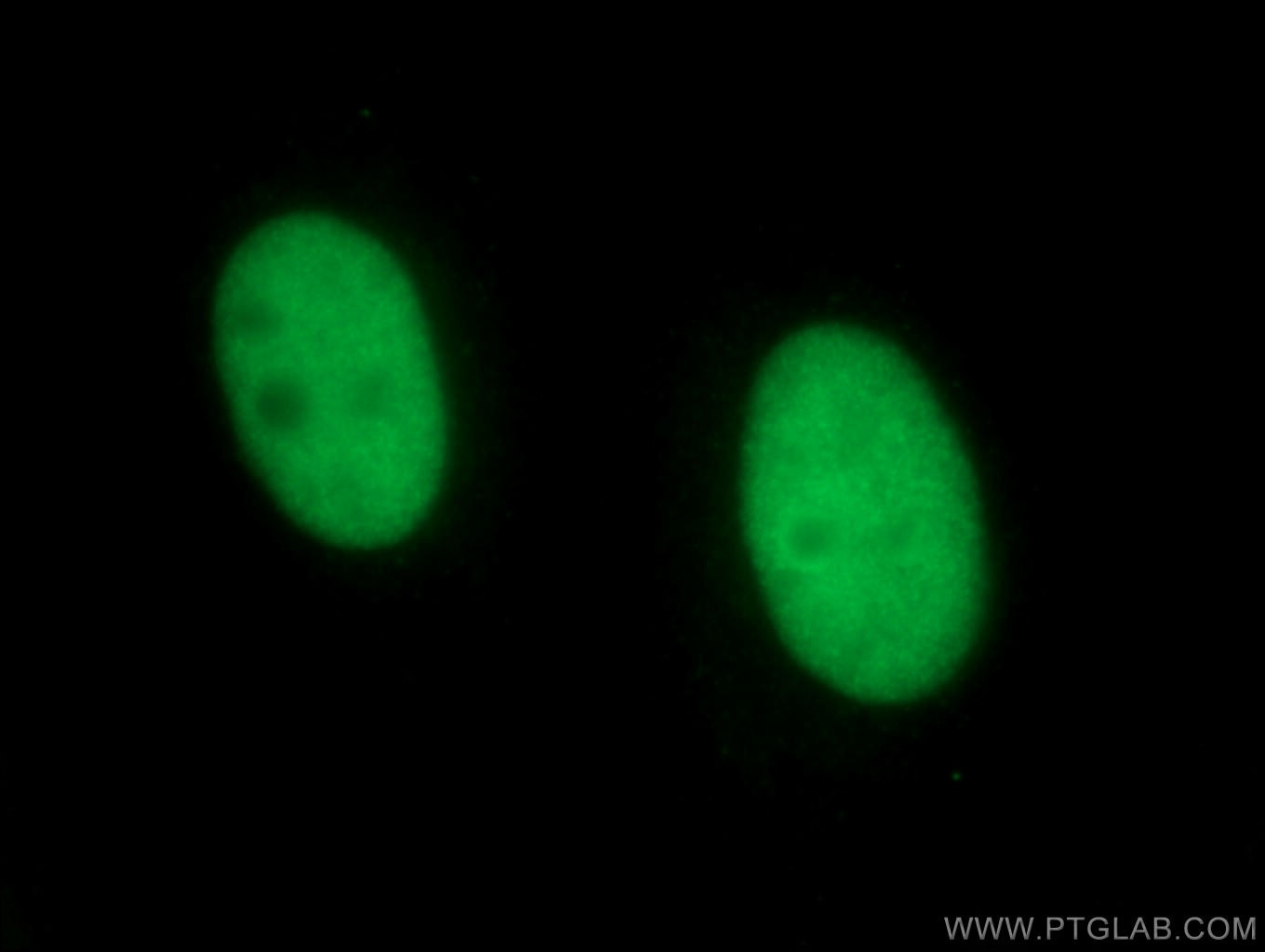 Immunofluorescence (IF) / fluorescent staining of HepG2 cells using NSUN2 Monoclonal antibody (66580-1-Ig)
