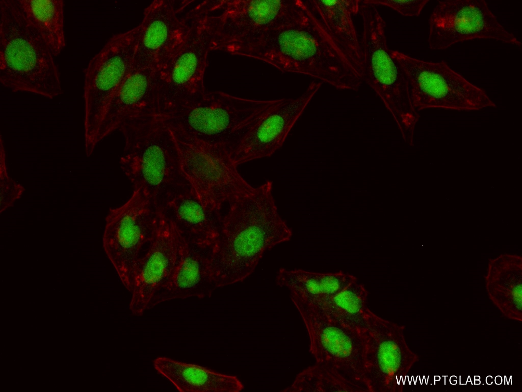 IF Staining of HepG2 using 82894-1-RR